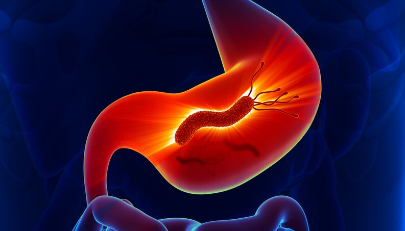 Jenis-Jenis Kanker Yang Sering Terjadi di Indonesia